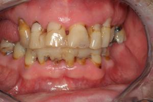 decaying smile in need of restoration